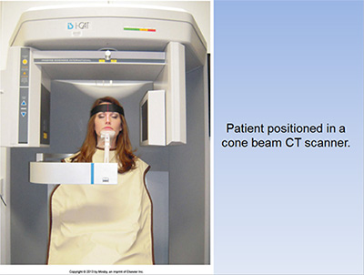 tmj cone beam scan tmj cone beam scan