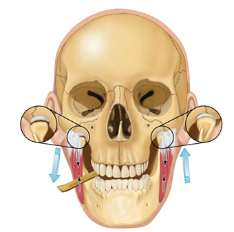 tmj dynamic loading tmj dynamic loading