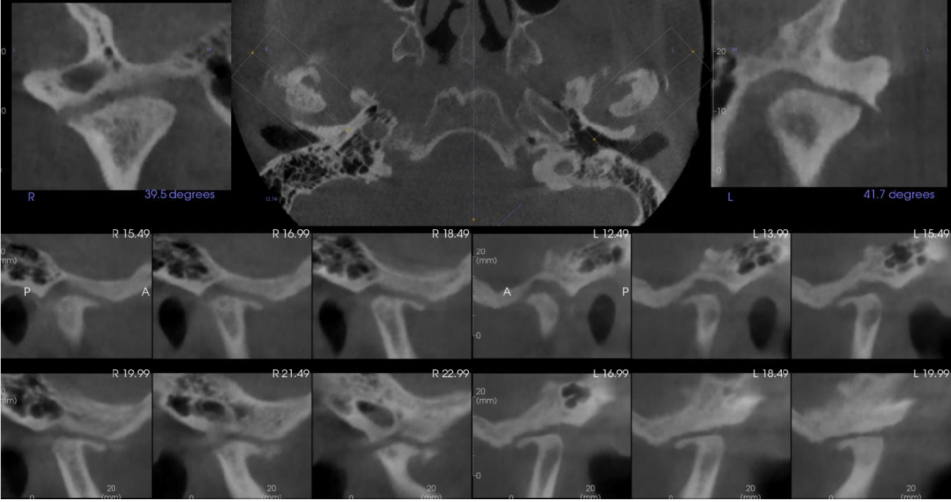 image3 TMJs, coronal, axial, and sagittal views