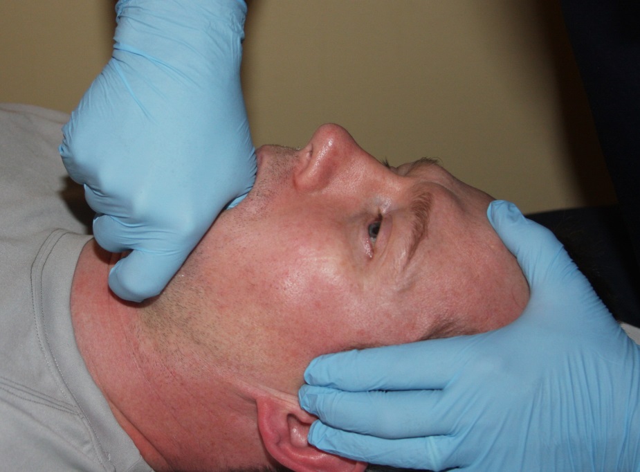 What is Trismus? And how best is it treated? Treating TMJ