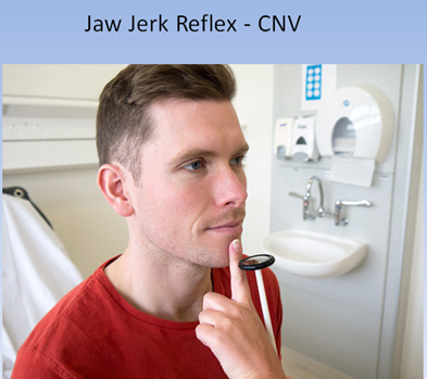 jaw jerk reflex jaw jerk reflex
