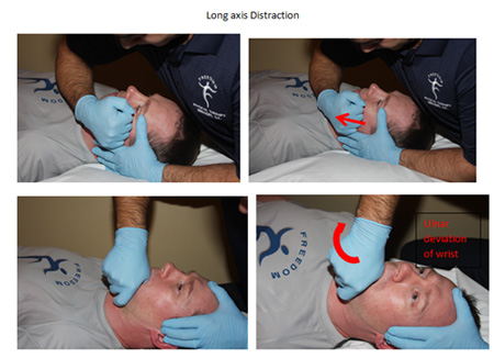 tmj joint mobility tmj joint mobility