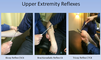 upper extremity reflexes upper extremity reflexes
