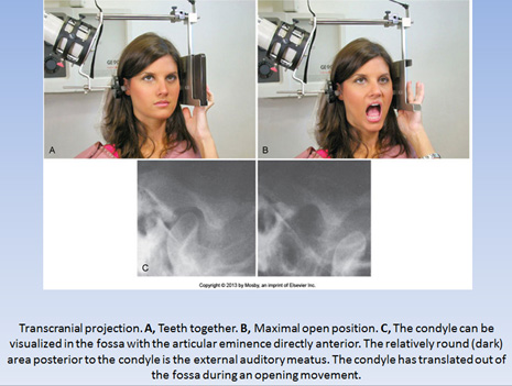 tmj xrays tmj xrays